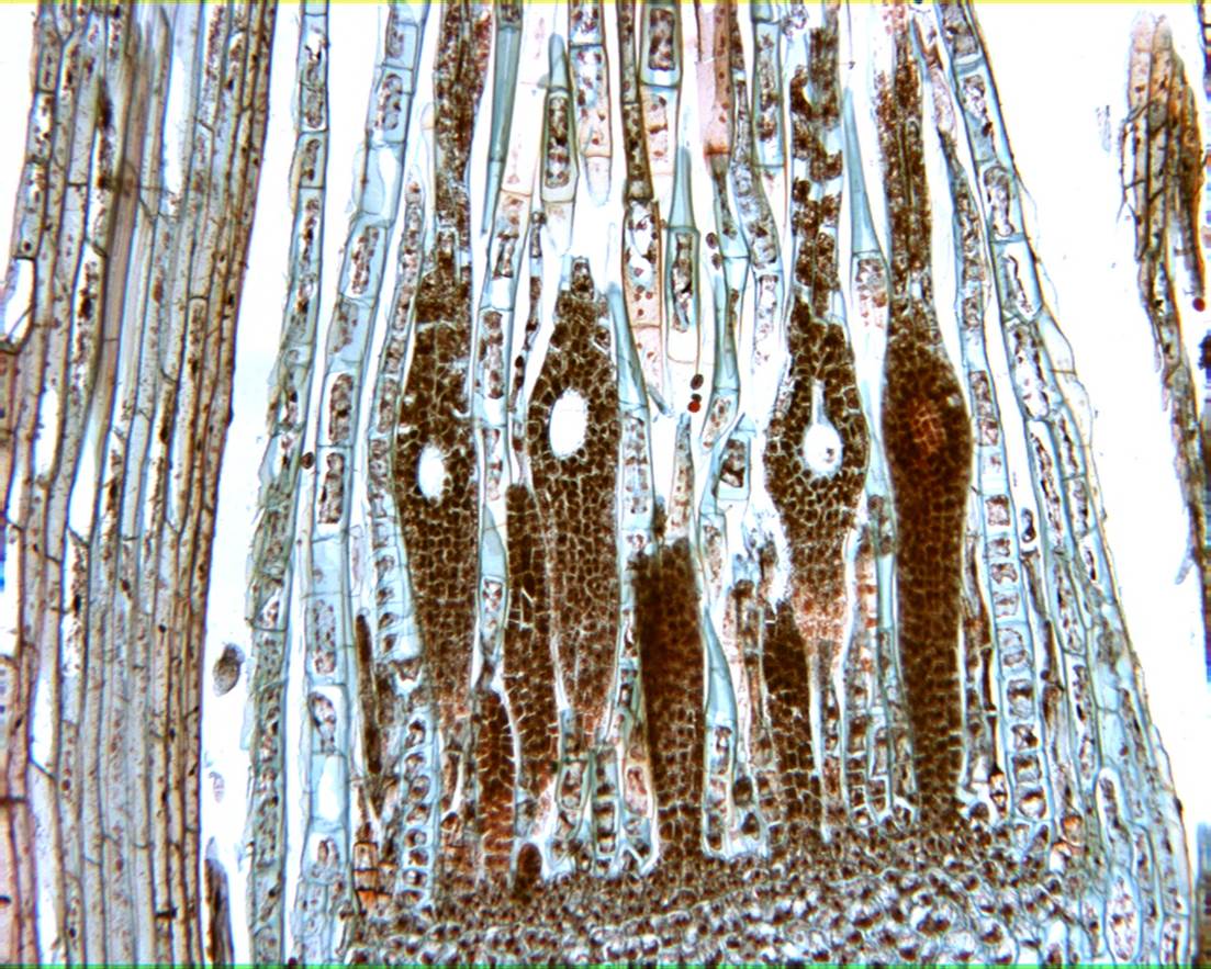 Moss Archegonia General Biology Lab Loyola University