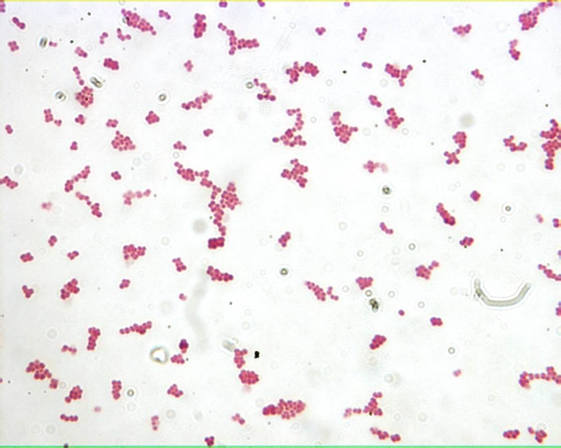 Bacteria Under Microscope 1000x - Micropedia