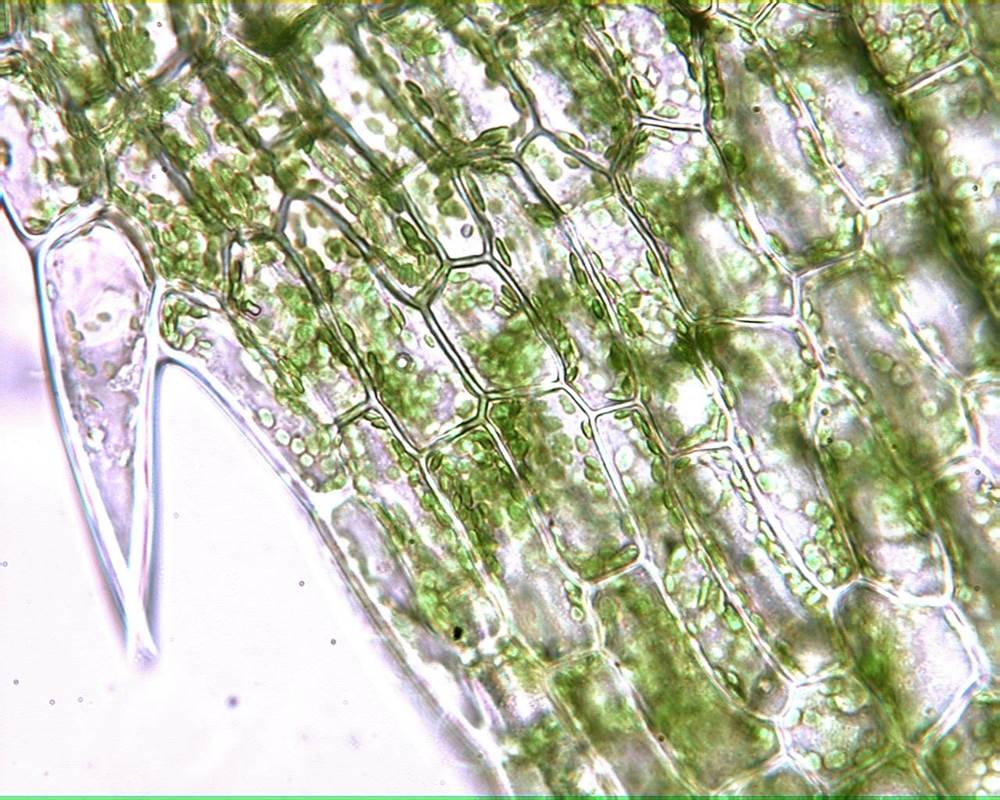 Elodea Leaf Under Microscope 40x Labeled - Infoupdate.org