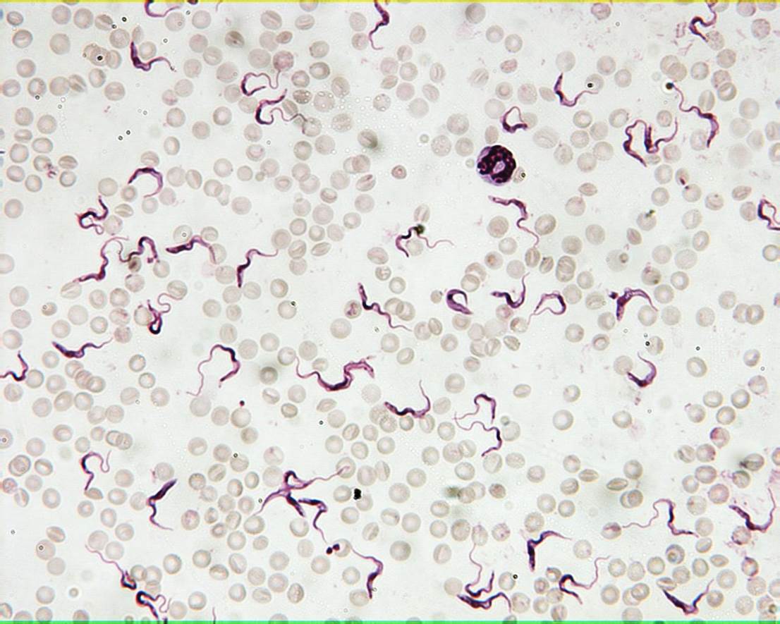 trypanosoma