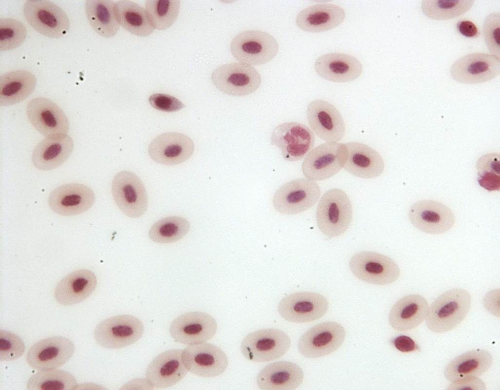 Frog blood 400X: General Biology Lab II: Loyola University Chicago