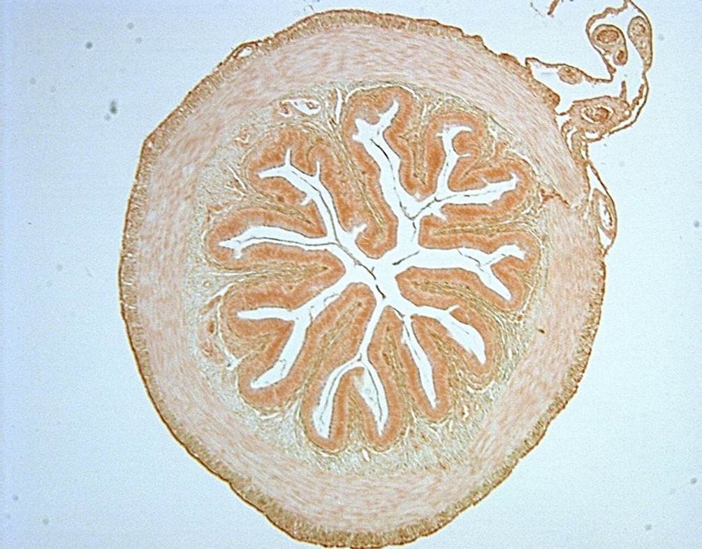 intestine-40x