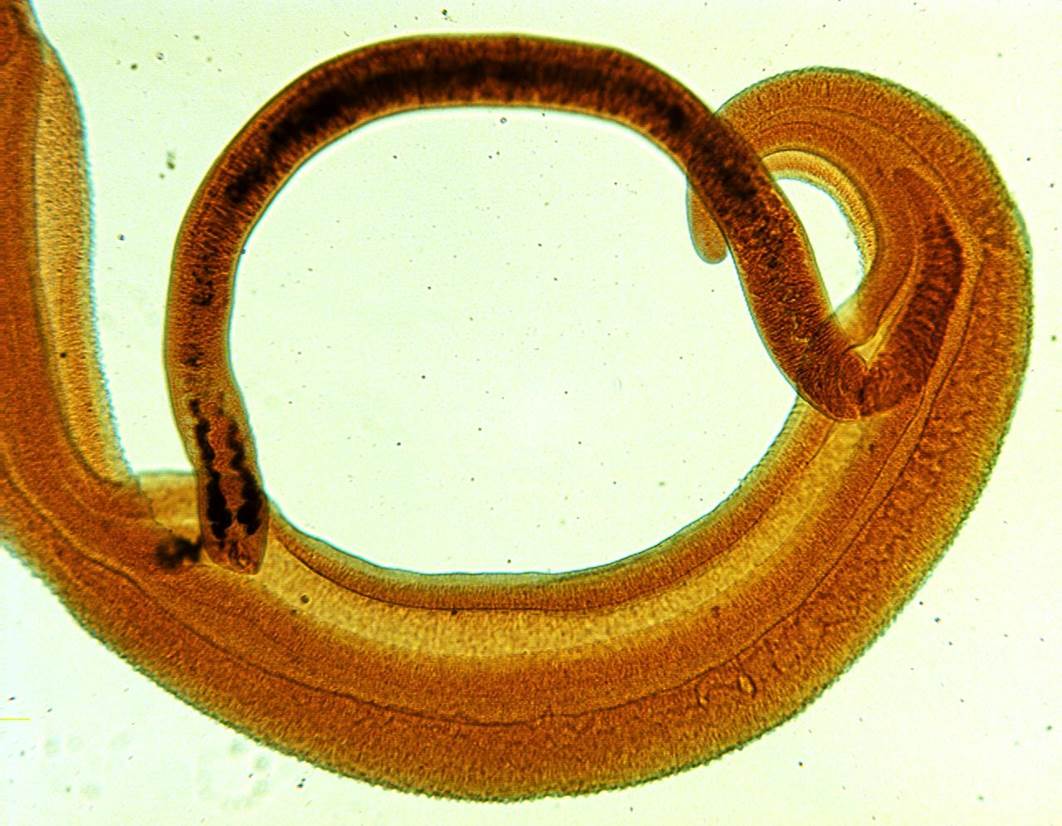 schistosoma-40x