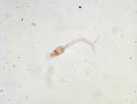 schistosoma-cercaria