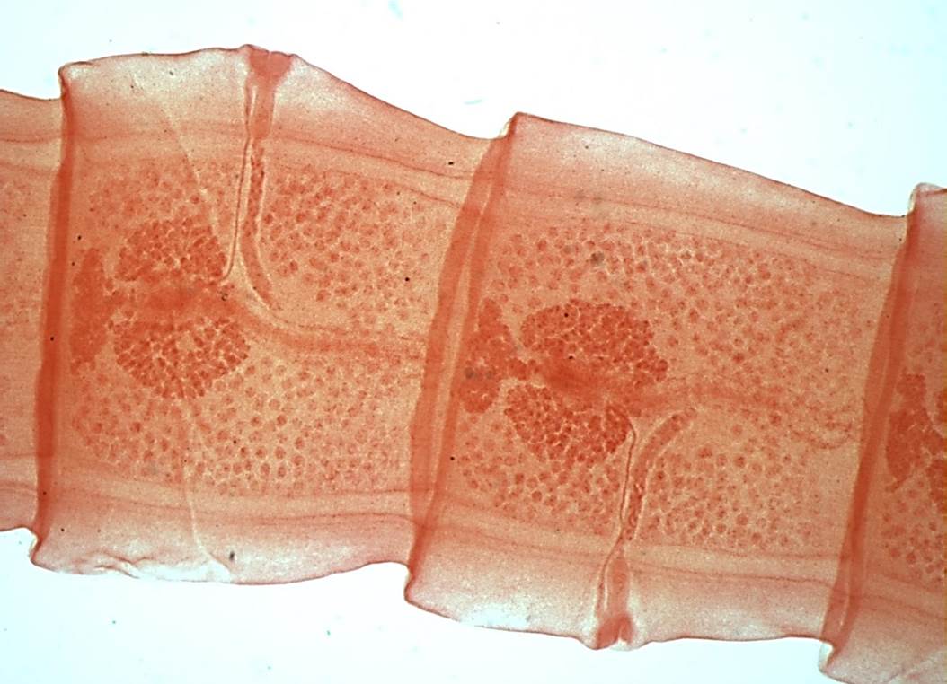 taenia gravid proglottid