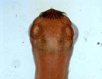 tapeworm-scolex