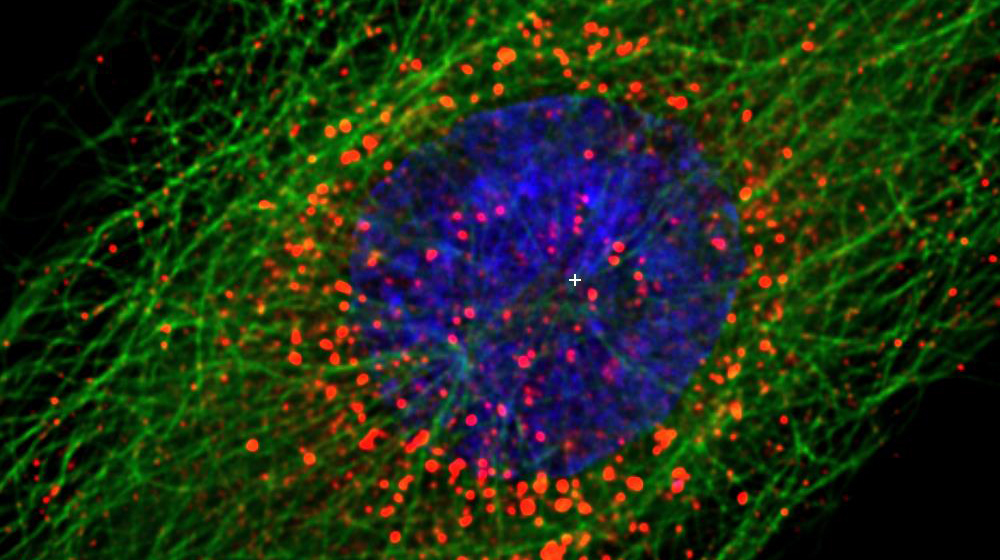Loyola study reveals how HIV enters cell nucleus
